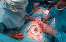 Moderní operace srdce bez otevření hrudní kosti. FN Olomouc rozšiřuje možnosti léčby