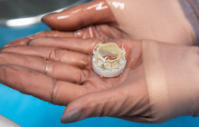 VIDEO: Kardiologové z FN Olomouc využili náhradu aortální chlopně. Byli první v republice