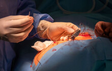 Další prvenství olomoucké fakultky. Jako první voperovali pacientovi nový stimulátor