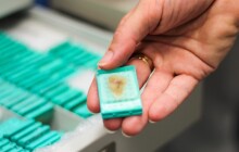 Co víte o Alzheimerově chorobě? Zkoumá ji olomoucká Mozková banka