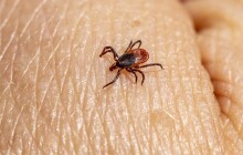 Hygienici varují před výskytem klíšťat, hlavně v okrese Šumperk a Jeseník