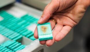Co víte o Alzheimerově chorobě? Zkoumá ji olomoucká Mozková banka