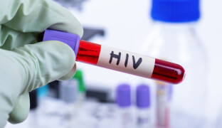 Olomoucká fakultní nemocnice otevřela v lednu HIV centrum. Už eviduje desítky pacientů