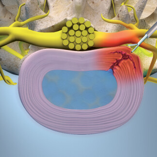 zdroj: EuroPainClinics