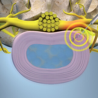 zdroj: EuroPainClinics