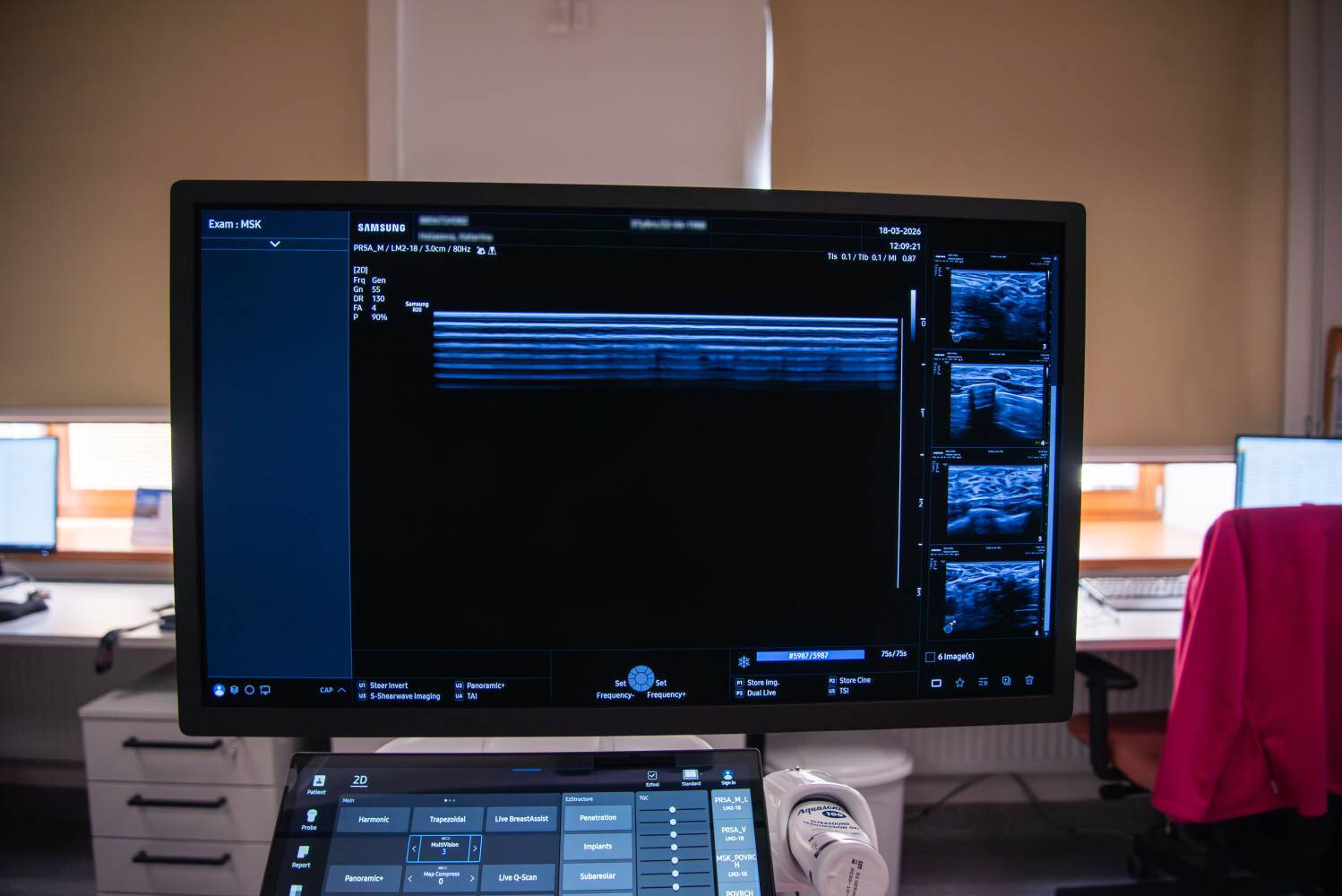 zdroj: Fakultní nemocnice Olomouc