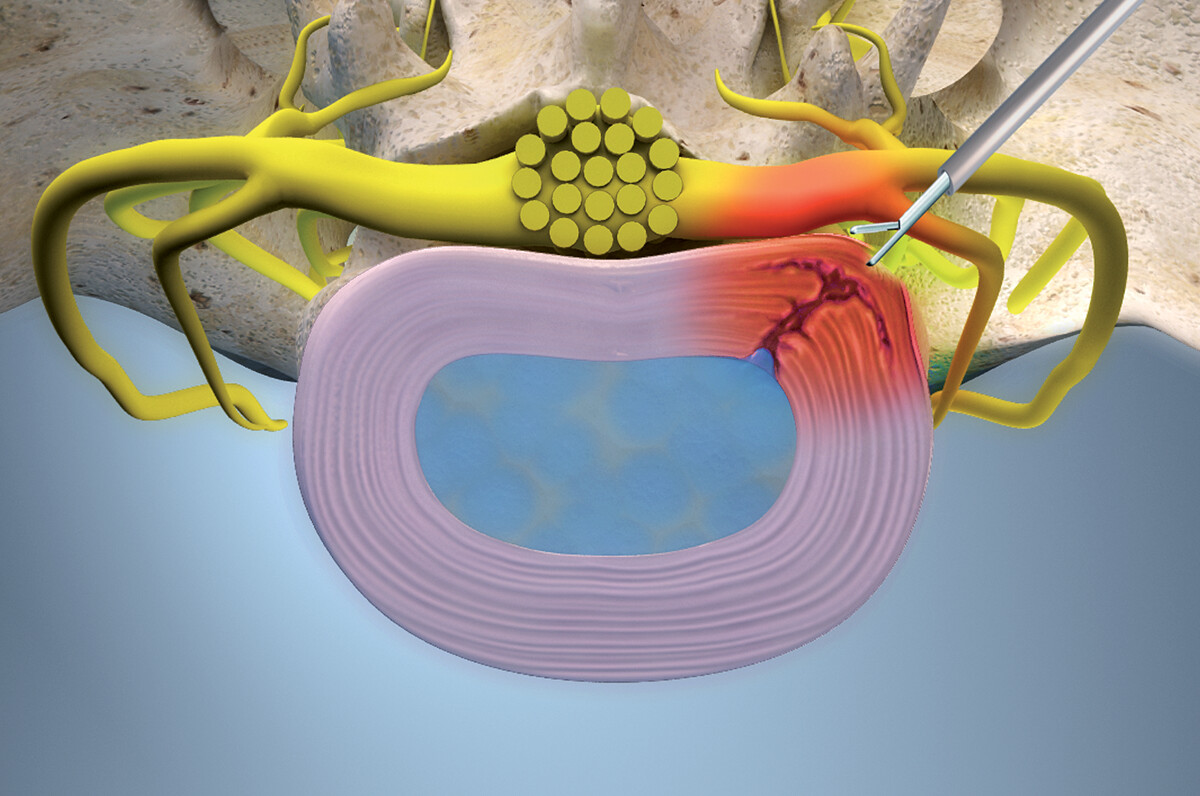 zdroj: EuroPainClinics
