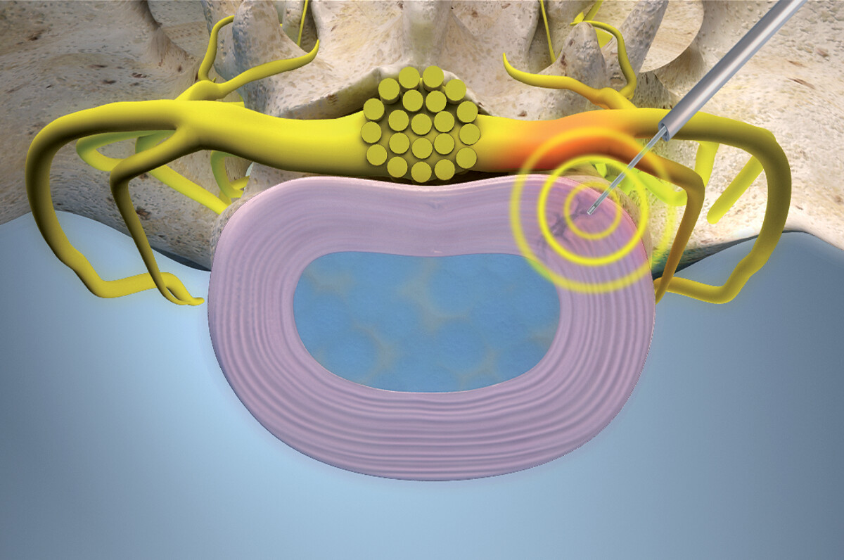 zdroj: EuroPainClinics