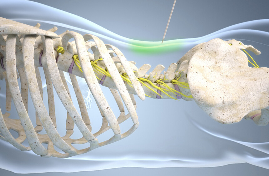 zdroj: EuroPainClinics