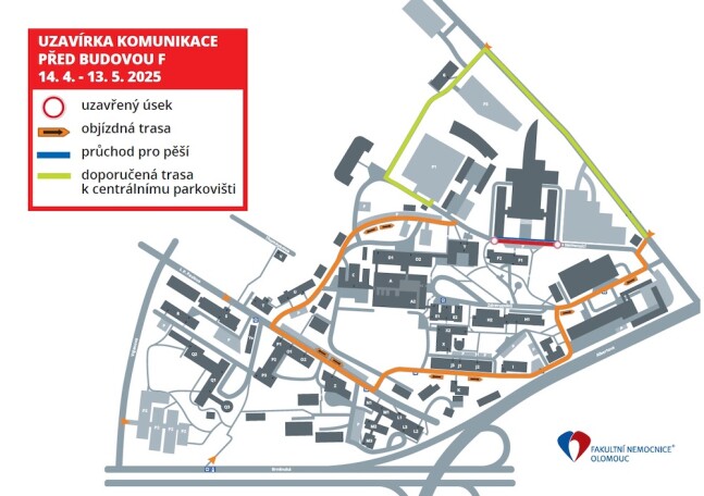 Zdroj: FN Olomouc