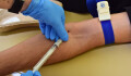 REPORTÁŽ: Počet nakažených roste. Vydali jsme se na testy HIV